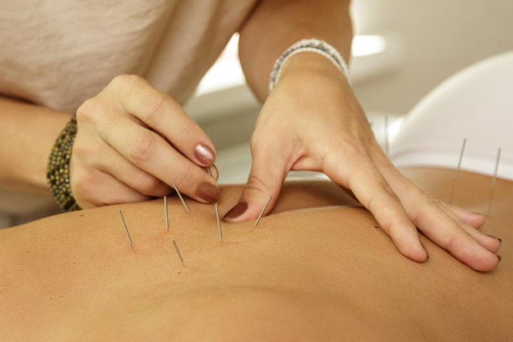 Hva er forklaringen ved akupunktur